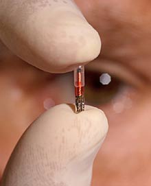 microchip